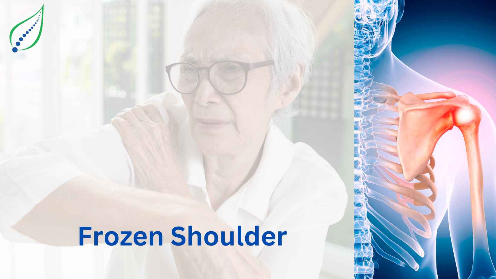 Frozen Shoulder